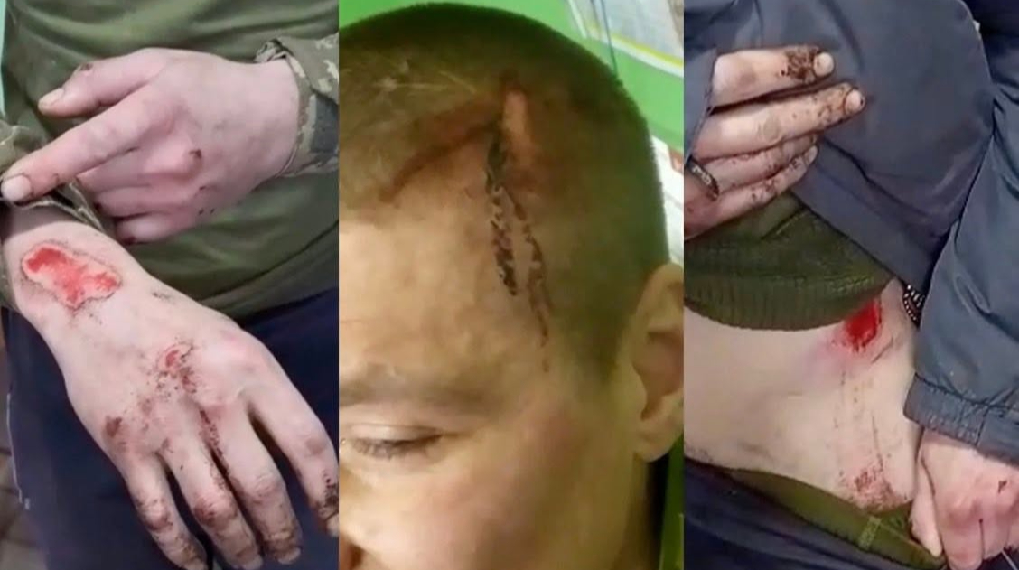 Розслідування «Бабеля»: серед новобранців 425-го полку «Скеля» за пів року зафіксували щонайменше 26 смертей